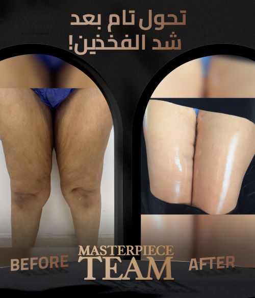 افضل دكتور تجميل في الرياض